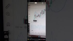 Deriv analysis setting and bot settings
